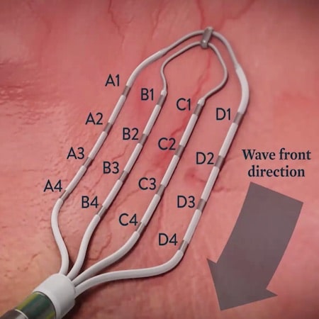 Advisor HD Grid Catheter