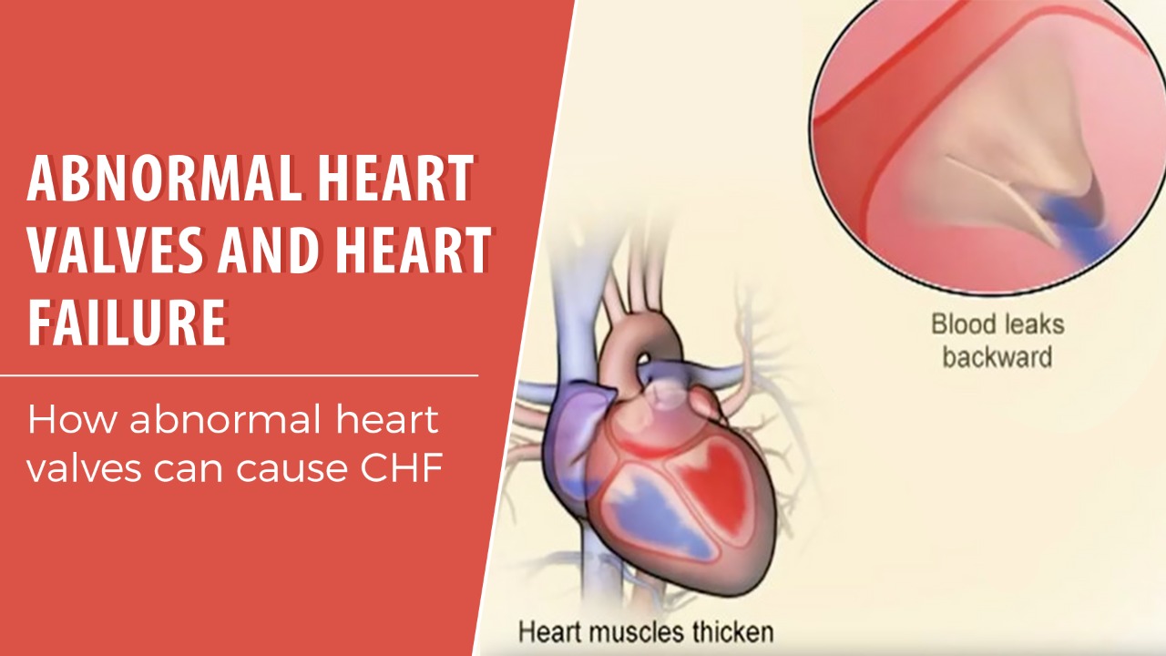 Abnormal heart valves and heart failure