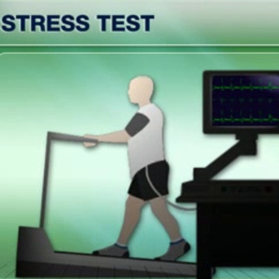 Exercise Stress Test