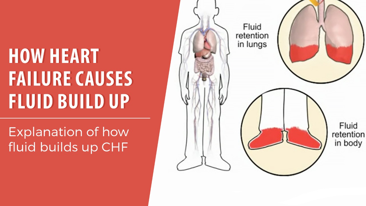 How Heart failure causes fluid build up
