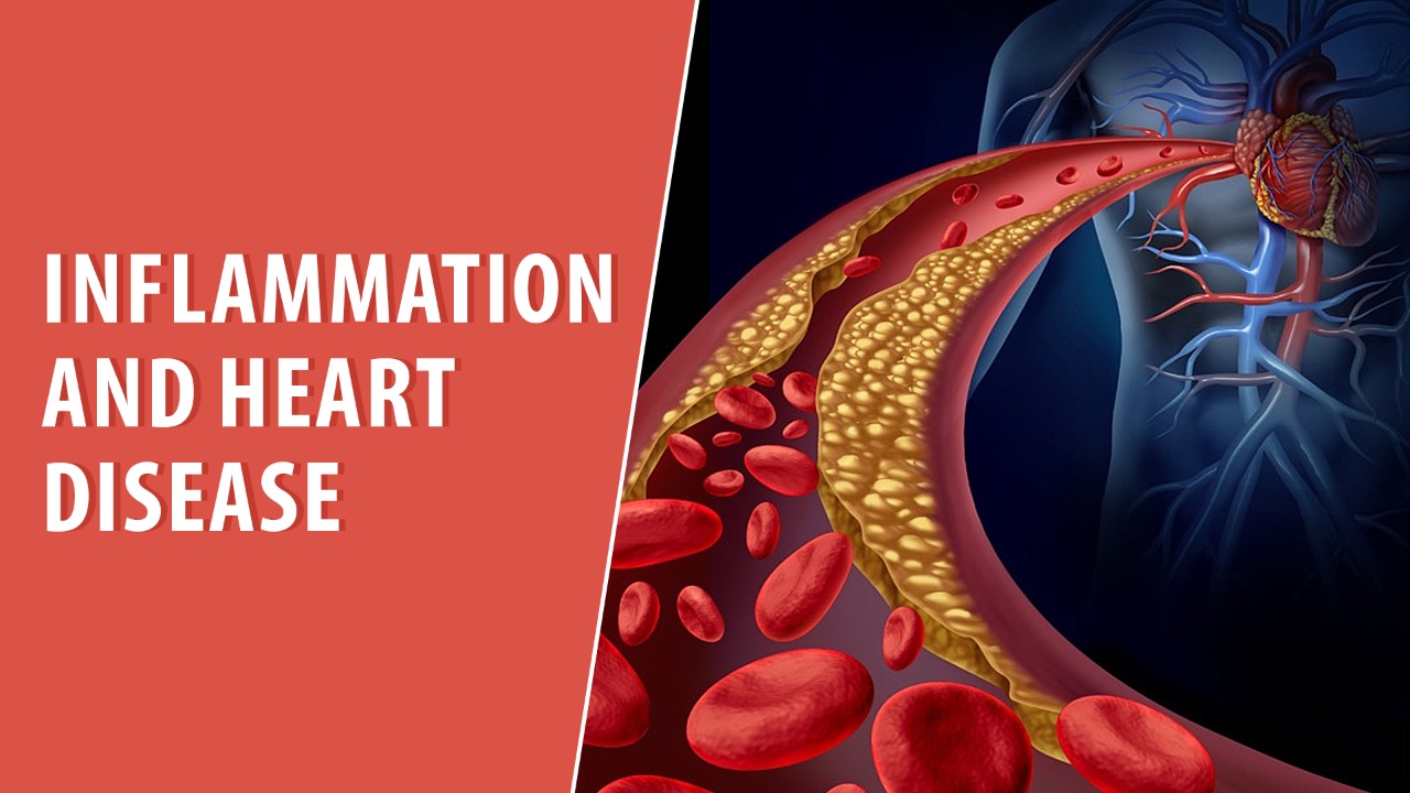 Inflammation and Heart Disease