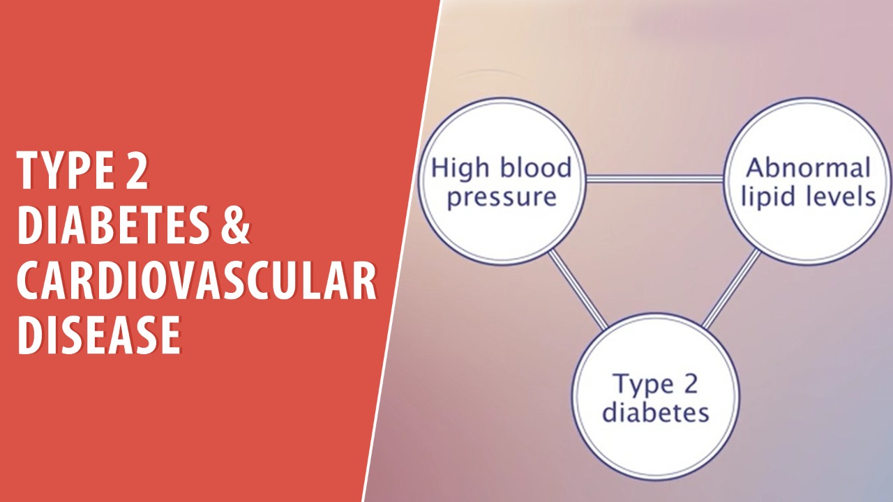 Type 2 Diabetes & Cardiovascular Disease