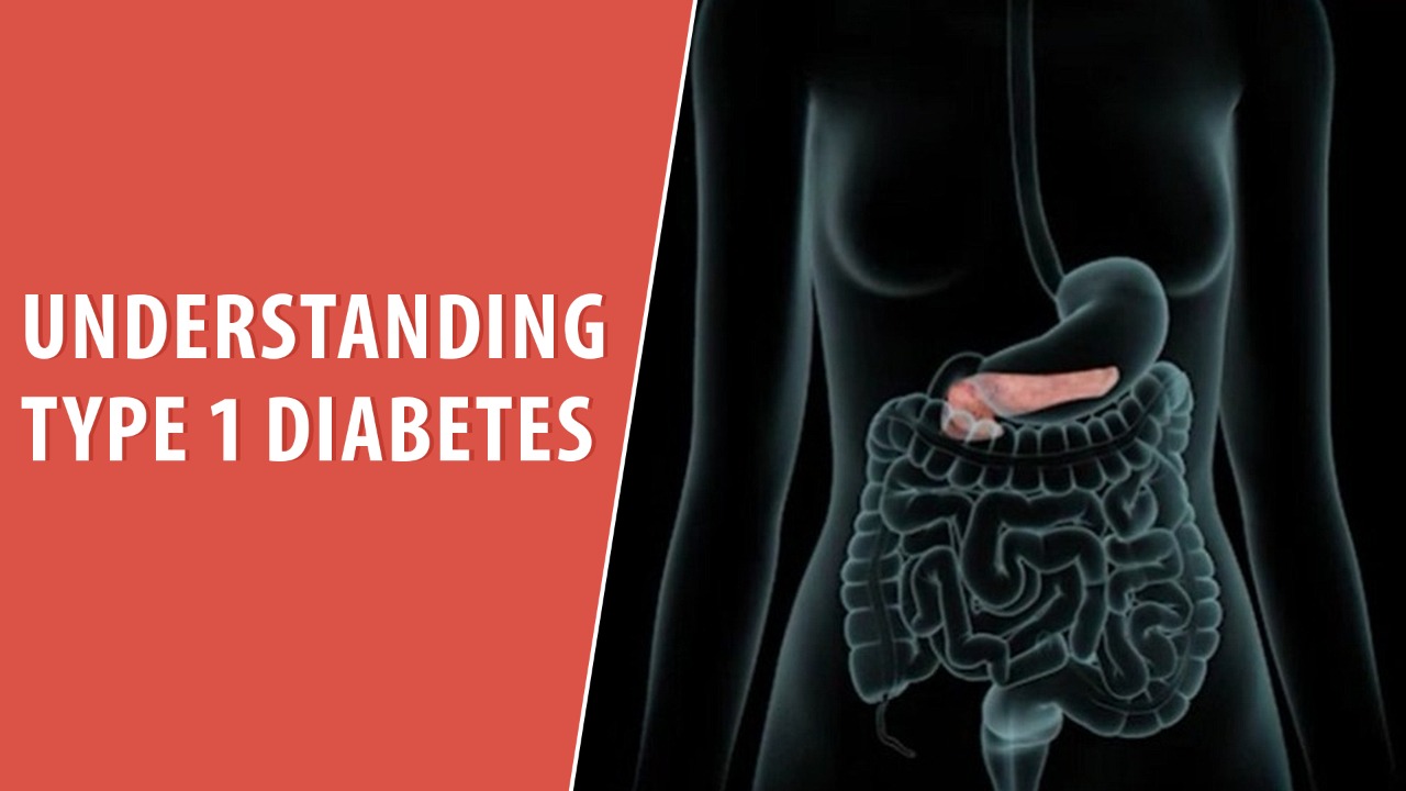 Understanding Type 1 Diabetes
