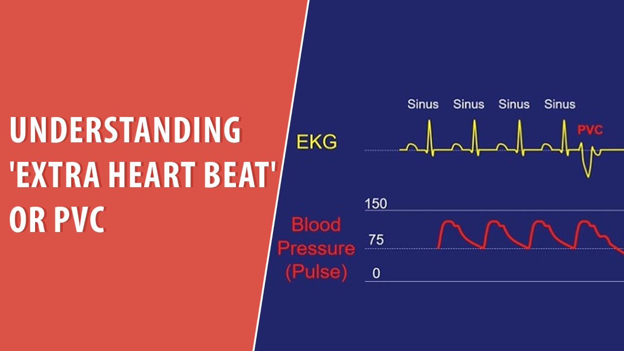 Understanding 'extra heart beat' or PVC