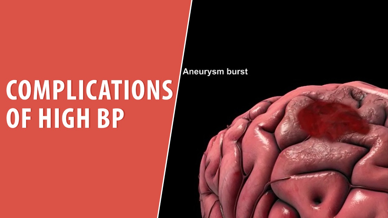 Complications of High BP