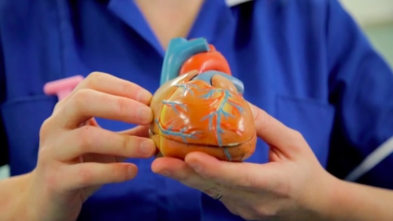 Coronary Heart Disease Coronary Heart Disease