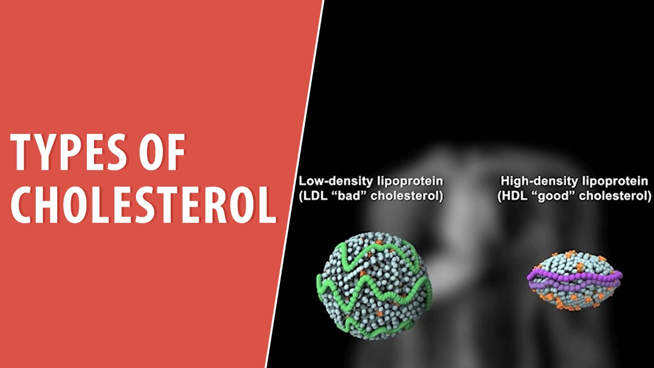 Types of Cholesterol