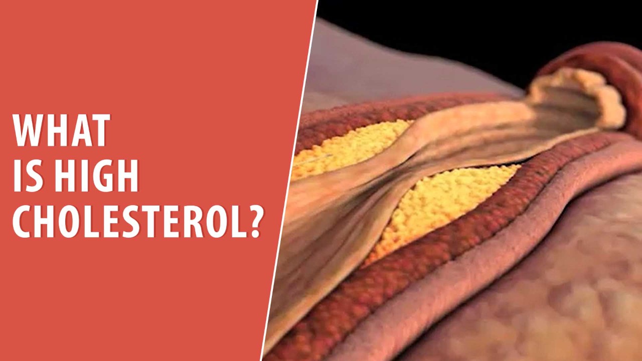 What is High Cholesterol