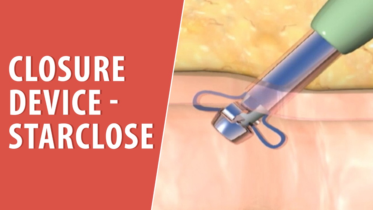 Artery hole clip device