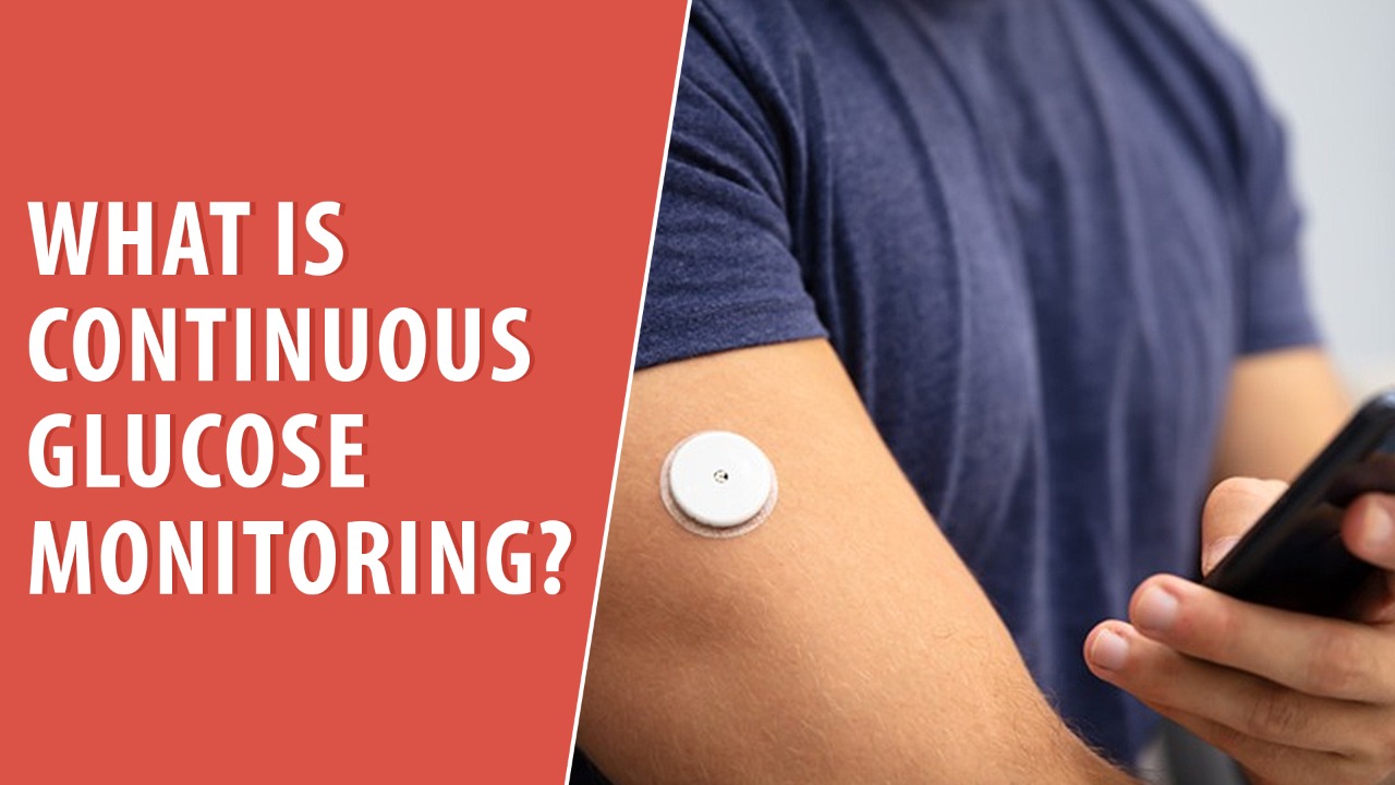 What is Continuous Glucose Monitoring?
