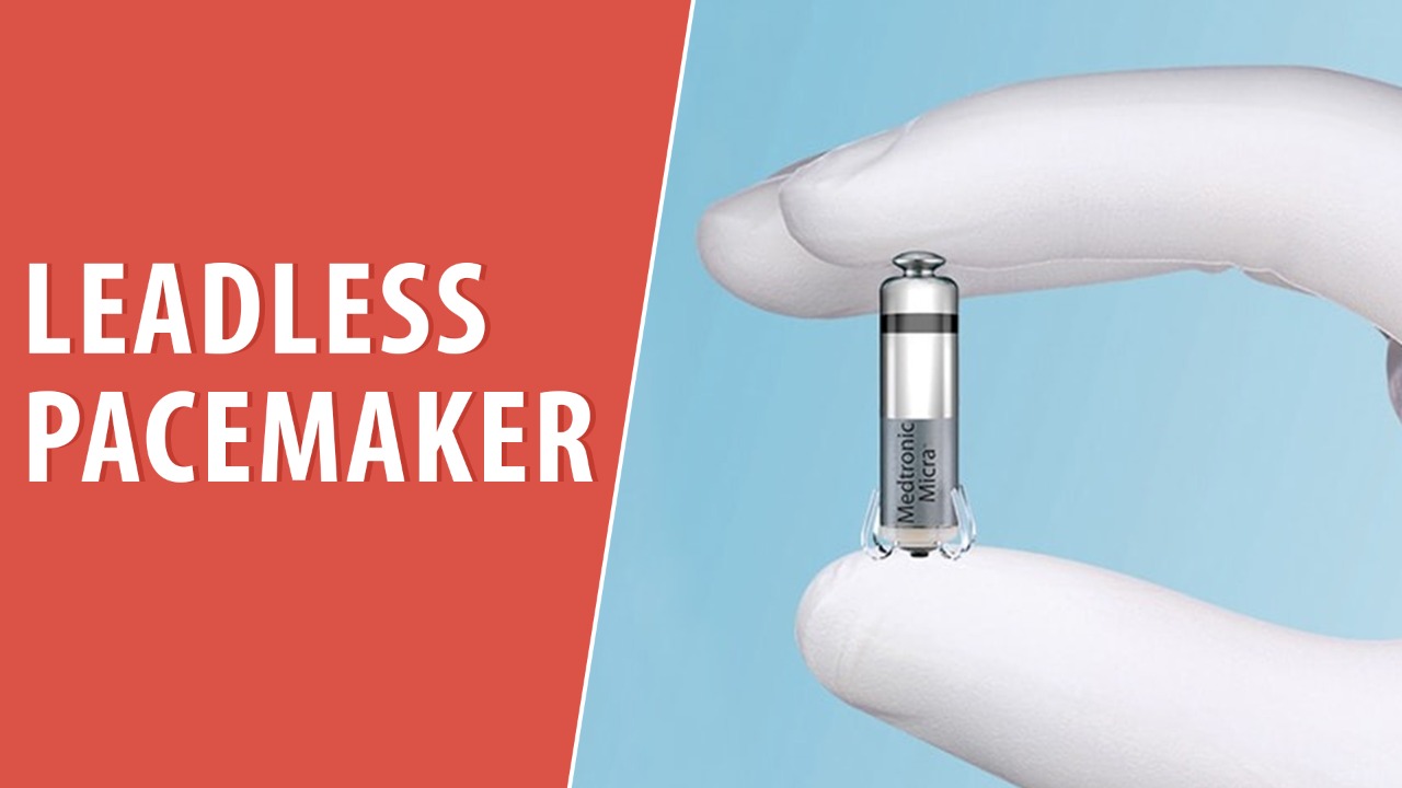 Leadless Pacemaker