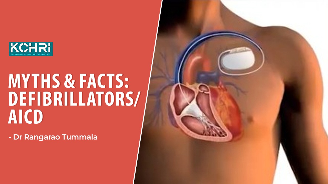 Myths & Facts: Defibrillators/AICD