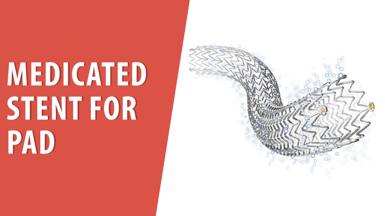 Medicated Stent for PAD