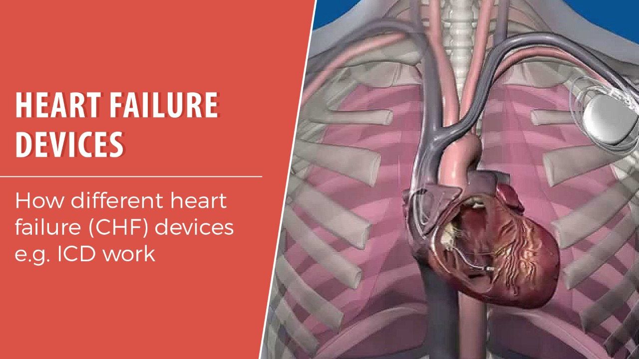 Heart Failure Devices
