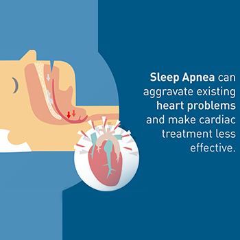 Watchman™Implant for AFib